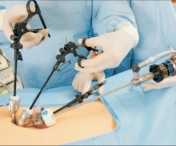 Clinica II Chirurgie Timisoara va avea un robot pentru operatii laparoscopice